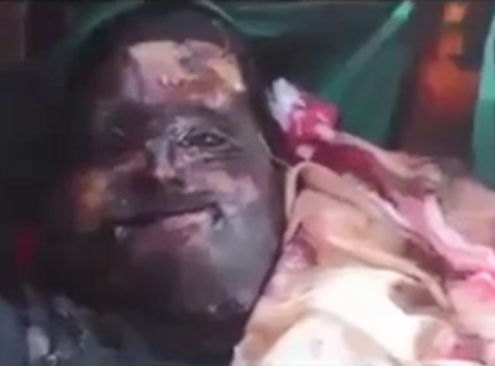 Fat man's corpse smiling - La Tia Del Gore 