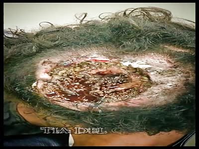 Rot in the skull, full of worms - La Tía Del Gore 