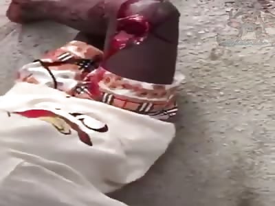 Police shoot a young boy in the leg