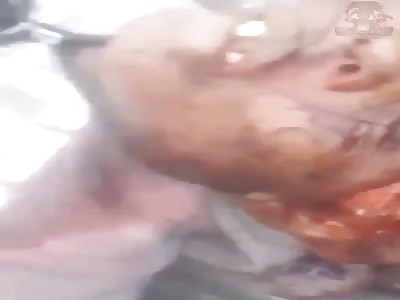 Woman with exploded head