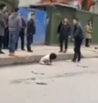 Split in Half From Accident....