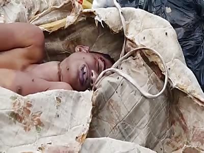 Dead body found in garbage container