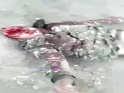 Armenian soldiers lie dead on the battlefield.