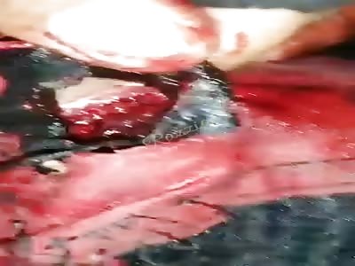 National Guardsman in MÃ©xico Wounded In Confrontation