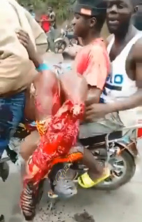 Dude Got Leg Fucked Up In Accident