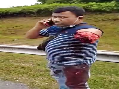 Biker loose arm (HORRIFIC)