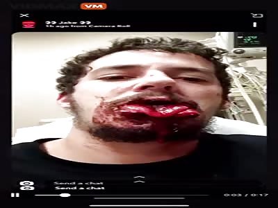 Guys..â€Bitingâ€