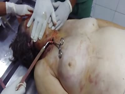 Old woman embalmed by strong female.