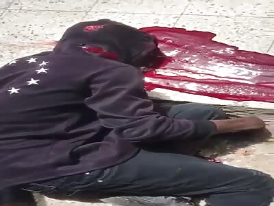 Laying In A Blood Pool