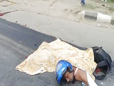 Biker Lost His Leg After Impact With Truck.