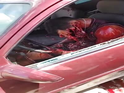 Dude's Face Fucked Up From Execution