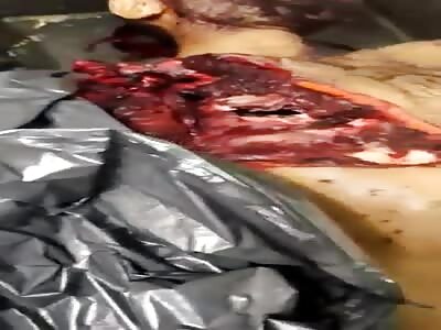 What A Surprise In The Morgue