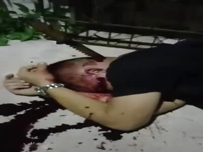 Knife Stuck In Dude's Head