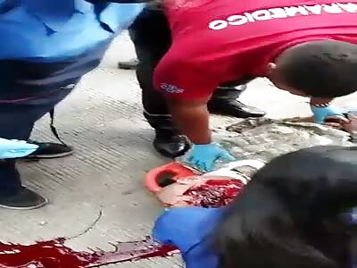 His Face Got Fucked Up