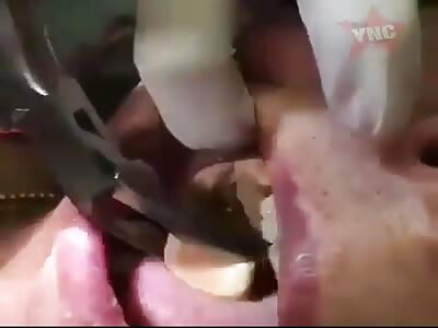 WTF. What is it about?