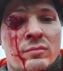 Beware of deer hunting (action & aftermath)