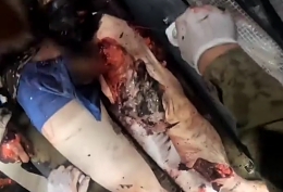 UA medics evacuating heavily wounded soldiers