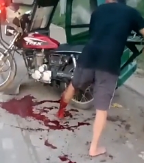 Man loses leg in road accident