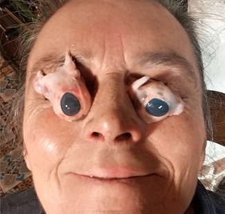 Death, Illness, Injury, Healing #3 (compilation)