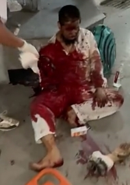 Indian train accident or failed suicide