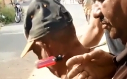 A Man's Painful Encounter with a Screwdriver