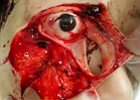 Death, Illness, Injury, Healing #9 (compilation)