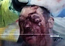 Aftermath of an accident on a quadbike