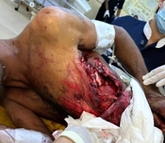 Fucked up by Boat Propeller 