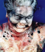 Death, Illness, Injury, Healing #12 (compilation)