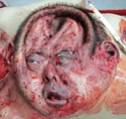 Death, Illness, Injury, Healing #13 (compilation)