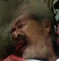 The daughter beat the father and cut out his tongue (aftermath)