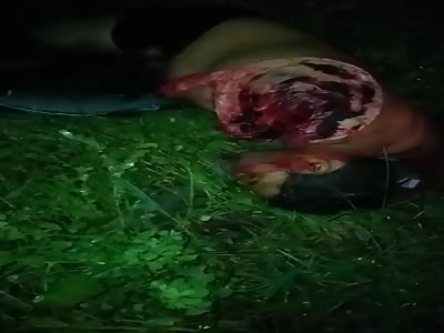 Limb ripped off in fatal traffic accident.