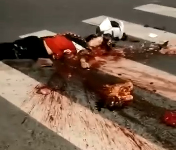 Biker's Heart Continues to Beat Outside the Body.