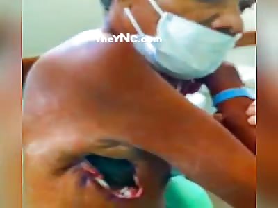 R.AKCA'S Gore Comp No.10