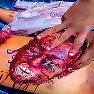 R.AKCA'S Gore Comp No.12