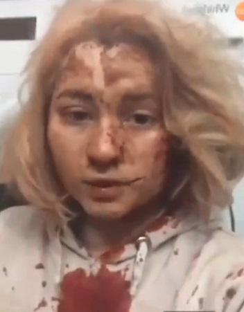 Pretty Girl Victim of Shelling.