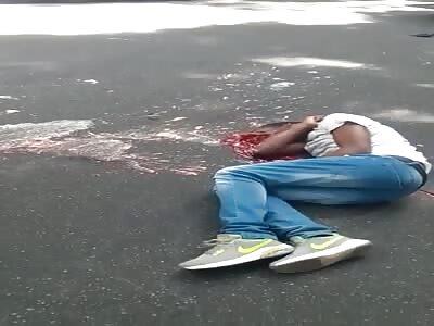 Man had skull hit by bus