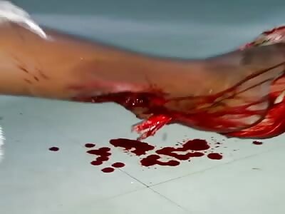 Man shot in the heel