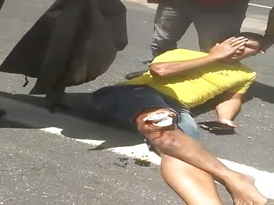 Damn, man got his knee popped in an accident