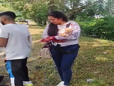 Couple attacked with machete in robbery (aftermath).