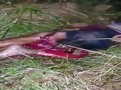 Skinny man has his leg severed in an accident.