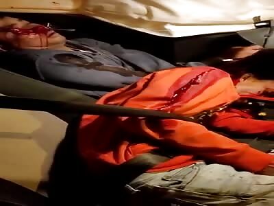 2 Victims seriously injured in Israel