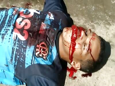 Victim of agony shot