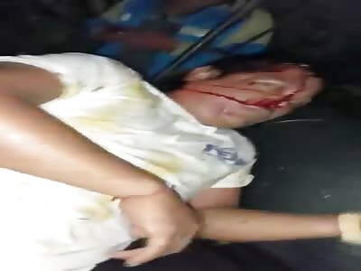 2 men on a motorcyclist are seriously injured when colliding with tree