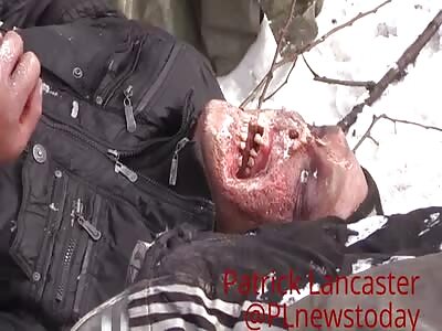 Faces of War in Ukraine