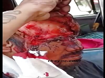 That's Not a Wig... It's a Legitimate Scalping