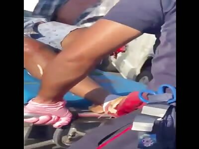 Victim has leg amputated in accident