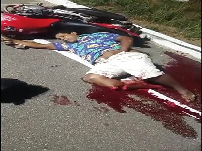 Poor biker has severed leg