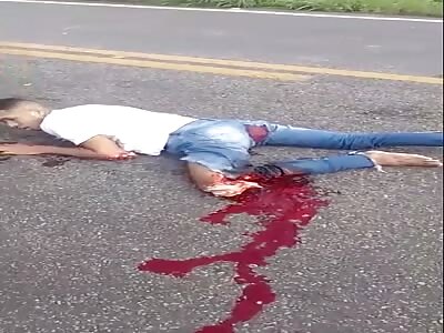 couple suffers serious accident