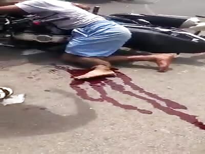 Victim with severe leg fracture.